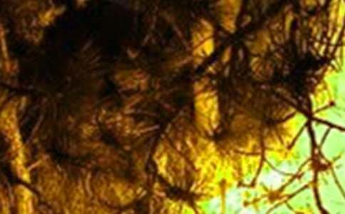 ɭ�ֻ��(z��i)�[���Ų����ι������Y(ji��)